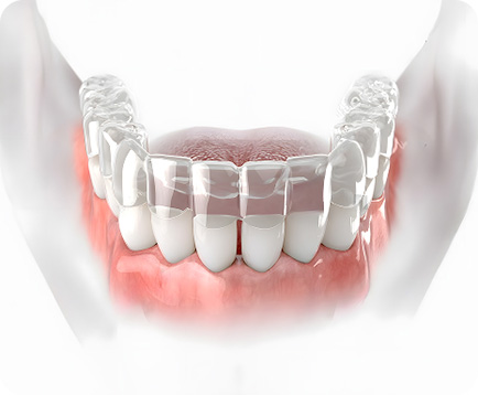 Dịch vụ: Niềng răng trong suốt