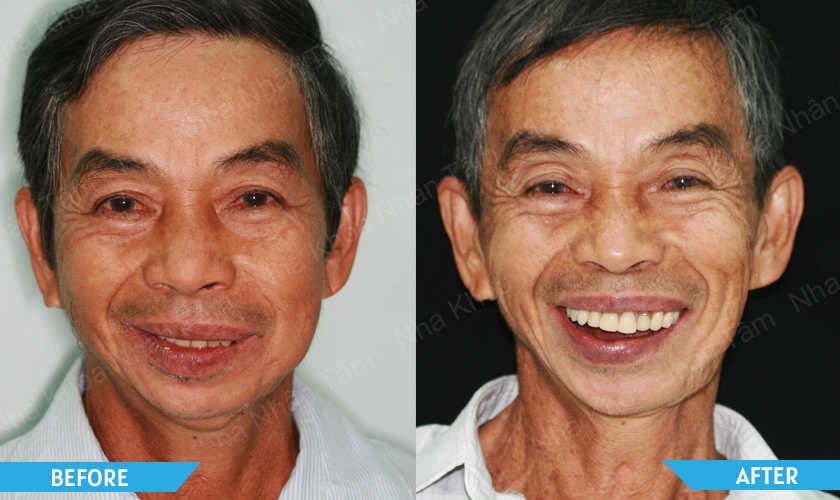 Dr Vo Van Nhan - And special cases