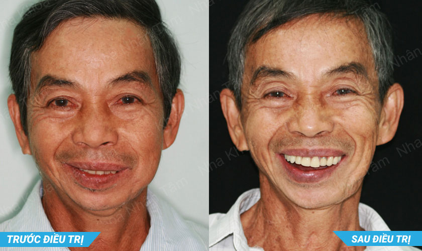 Tiến sĩ, Bác sĩ Võ Văn Nhân
