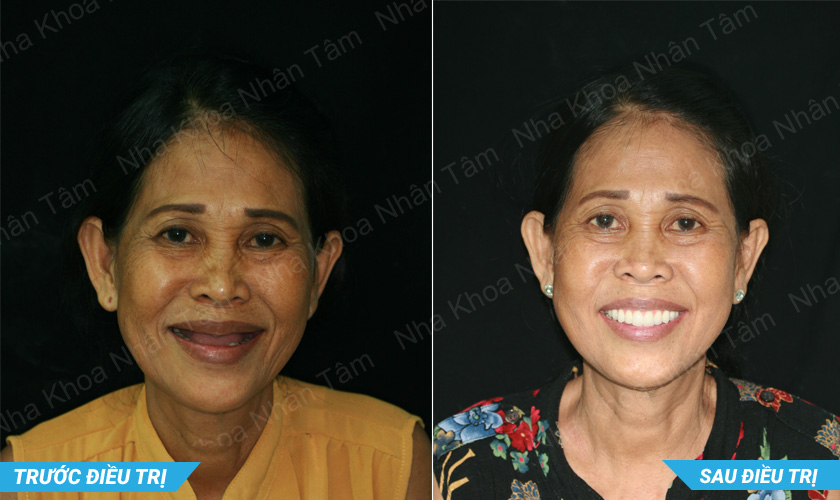 Tiến sĩ, Bác sĩ Võ Văn Nhân