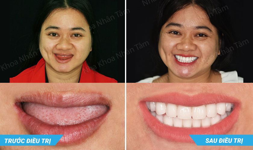 Tiến sĩ, Bác sĩ Võ Văn Nhân