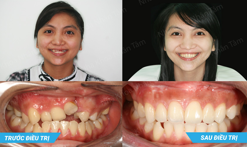 Tiến sĩ, Bác sĩ Võ Văn Nhân
