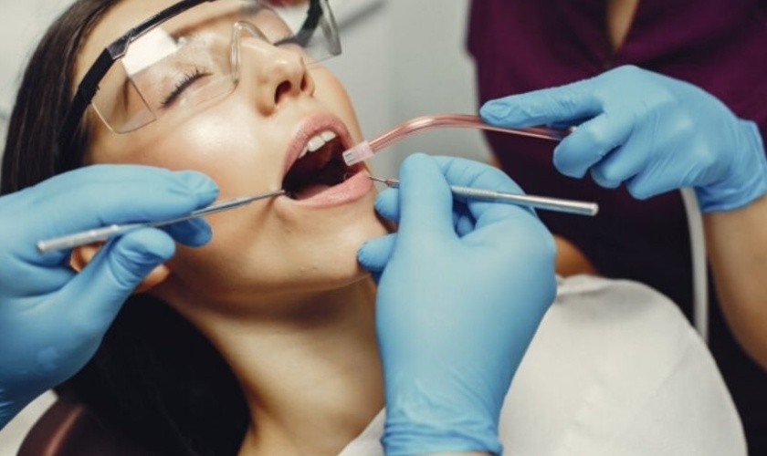Cạo vôi răng trước khi niềng răng