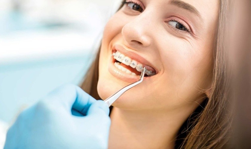 Braces help make the face more balanced and harmonious