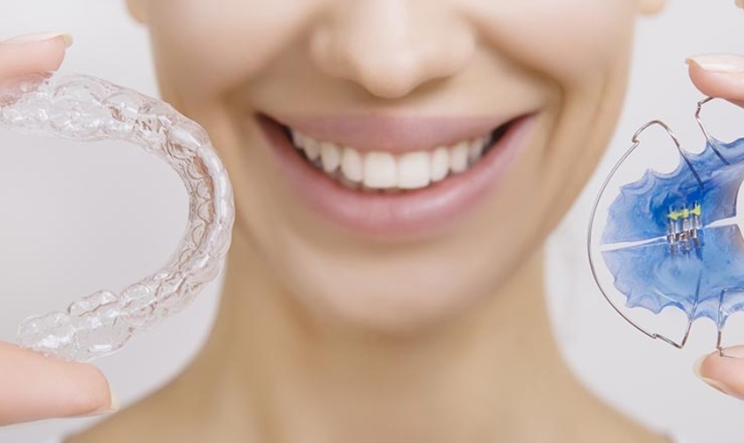 Hàm duy trì giúp đảm bảo kết quả niềng răng