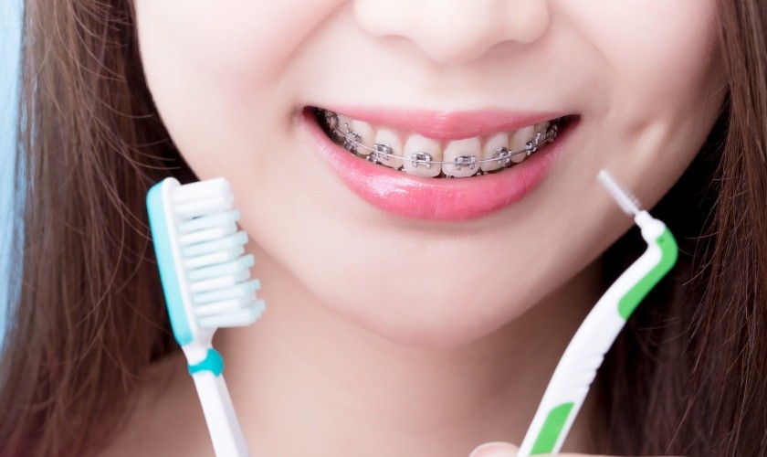 While wearing braces, you will practice thorough oral hygiene habits