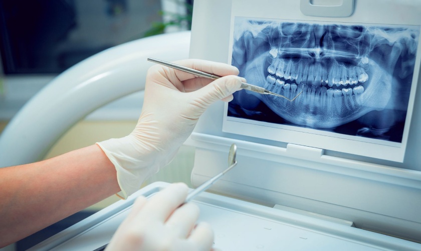 Surgical Orthodontics