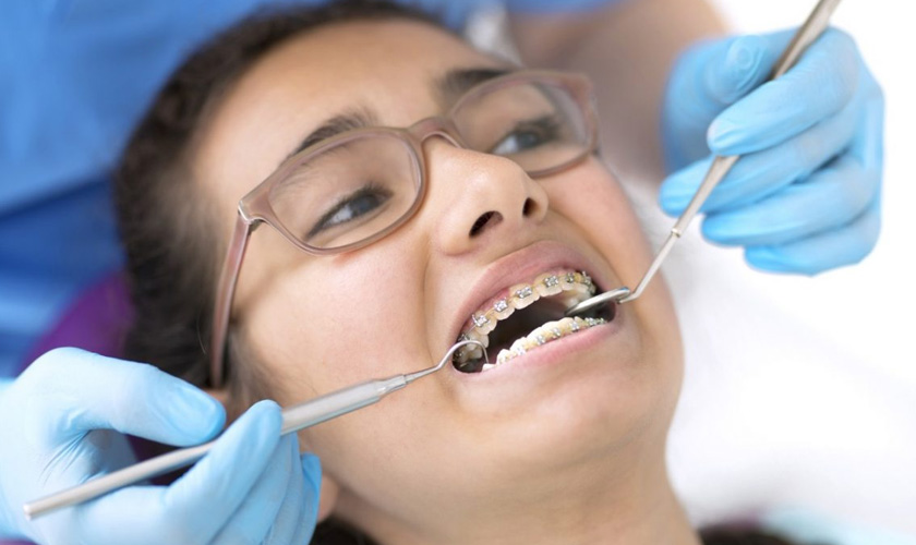 Why you need tooth extraction for braces?