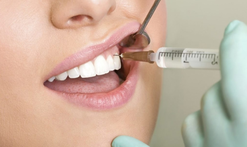 tooth extraction