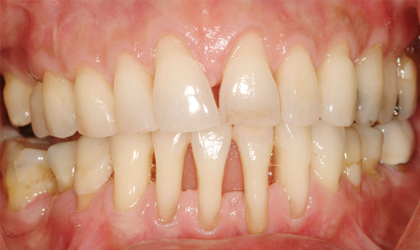 Hello doctors: Q&A about periodontal disease