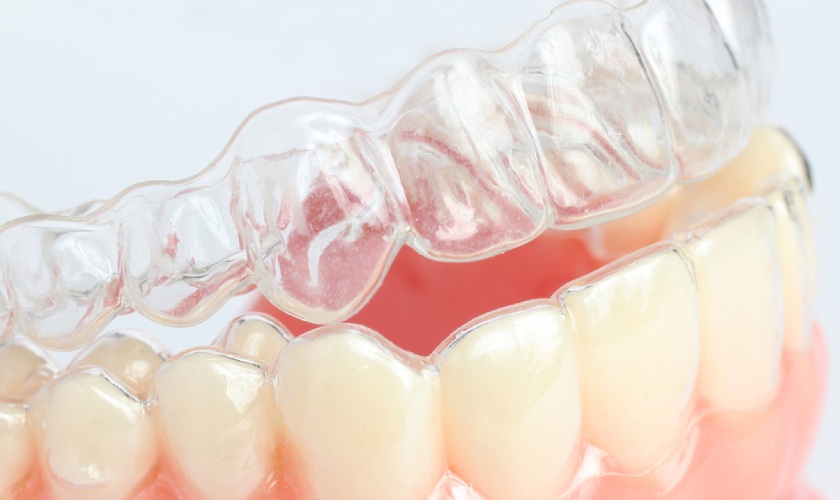 Vacuum formed retainer
