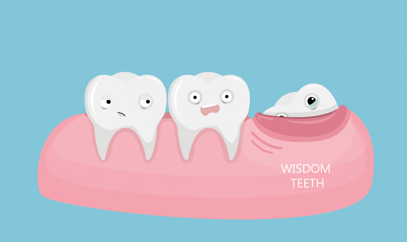 wisdom teeth