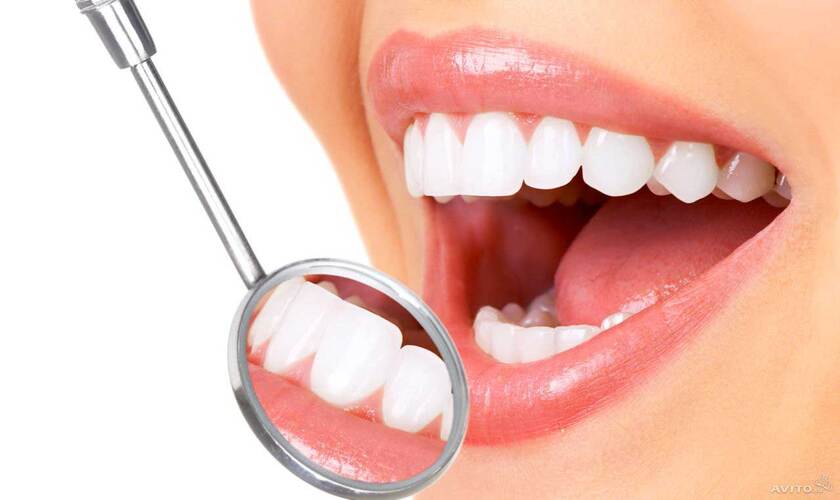 What are dental crowns?
