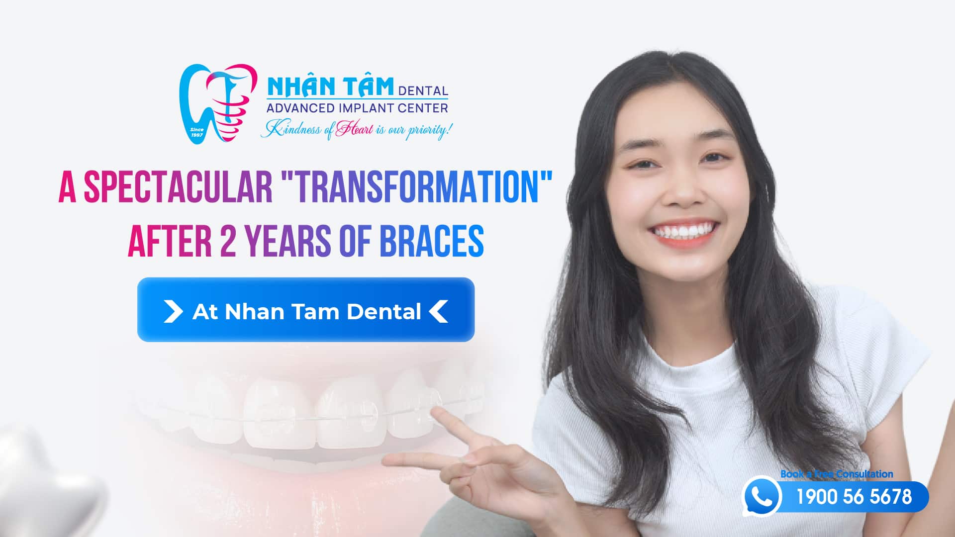 Hình: A spectacular transformation after 2 years of braces: from a self-conscious girl to a radiant muse