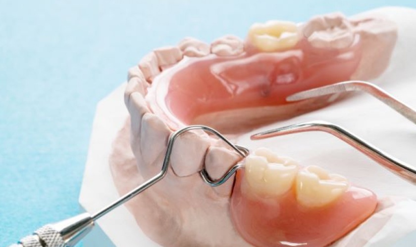 Removable dentures after a period of use will become loose, causing entanglement, discomfort