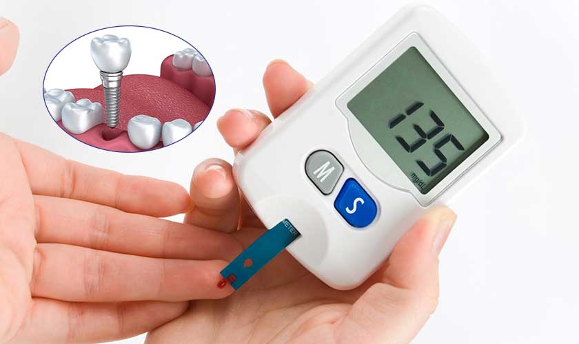 A few notes after dental Implant for diabetic patients