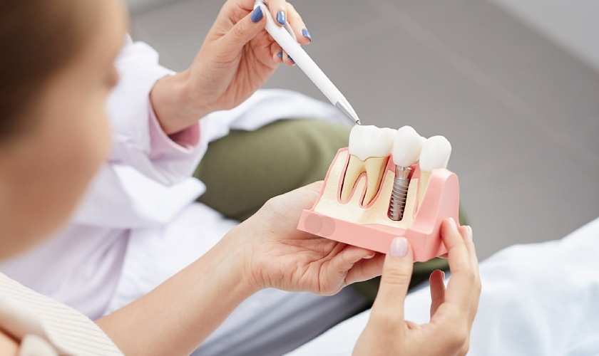 After placement of dental implants