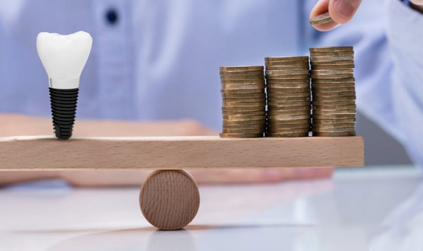 Are dental implants expensive?