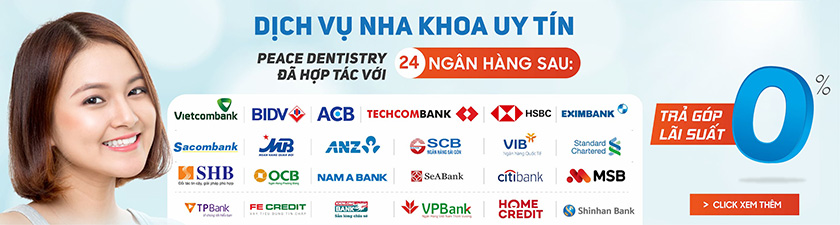 Trả góp lãi suất 0% dịch vụ niềng Tooth tại Nha khoa Nhân Tâm Trả góp lãi suất 0% dịch vụ niềng Tooth tại Nha khoa Nhân Tâm