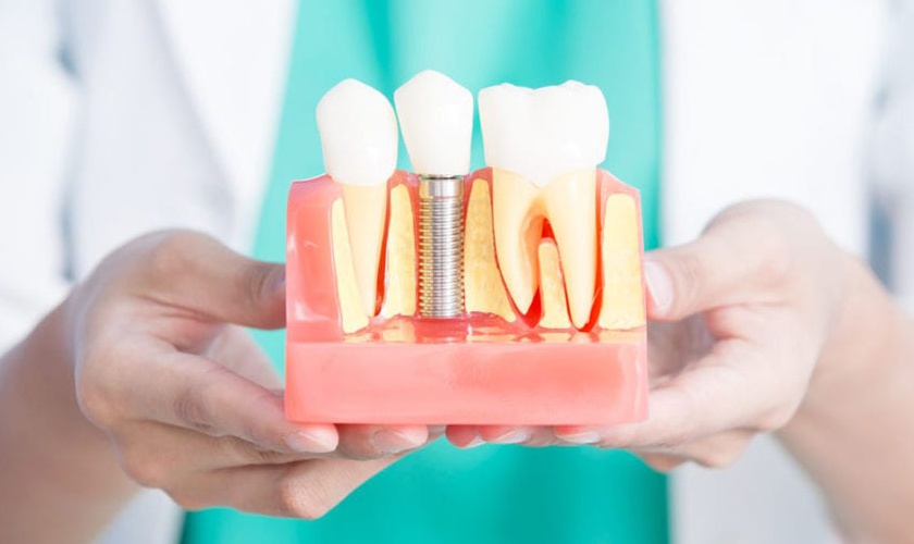 Do dental implants hurt?