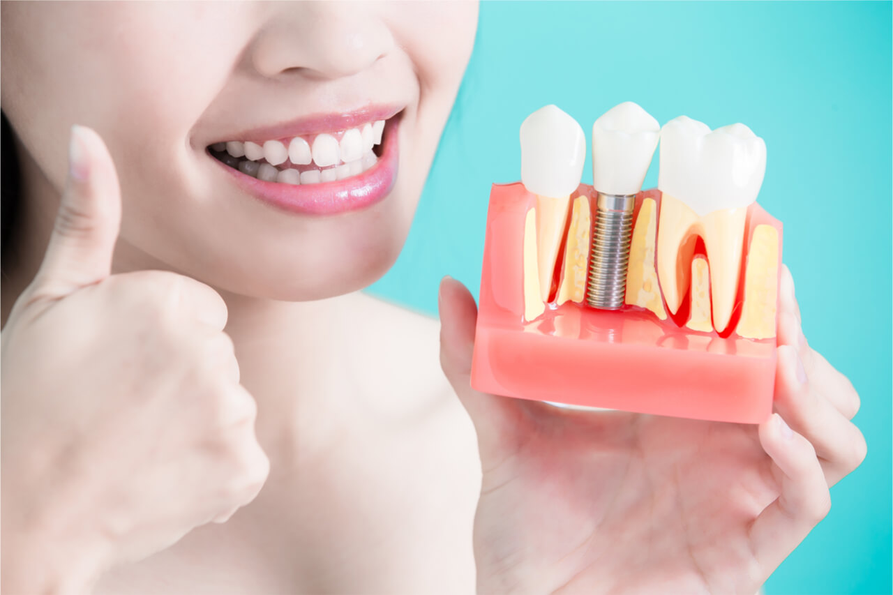 Factors determining the success of implant treatment