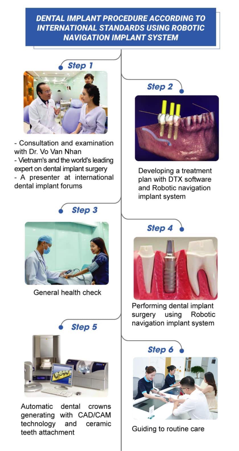 Dental implant navigation system offers many benefits for both doctors and patients