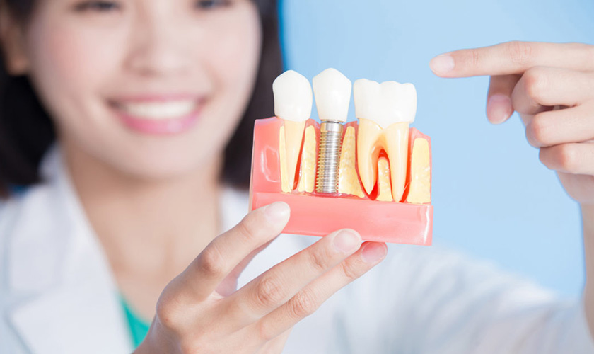 Implant Placement - The best dental restoration method but not everyone knows