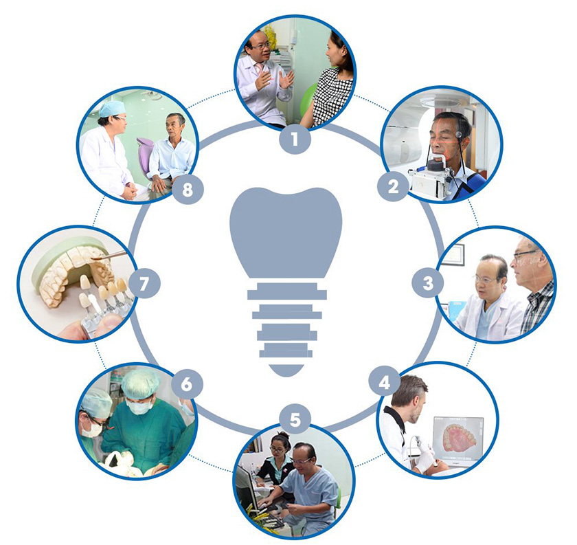 The dental implant process at Nhan Tam Dental