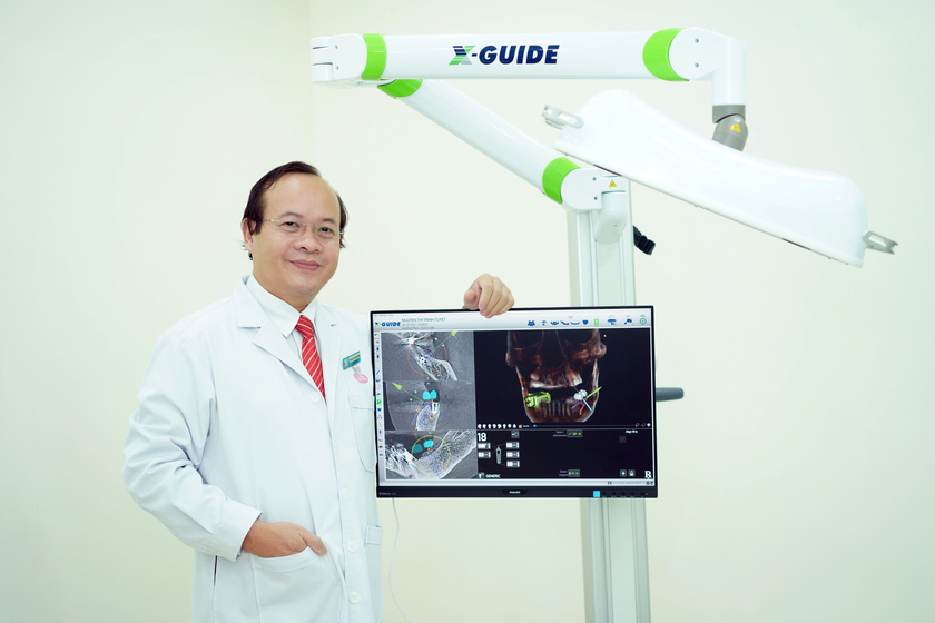 Kỹ thuật Implant All on 4