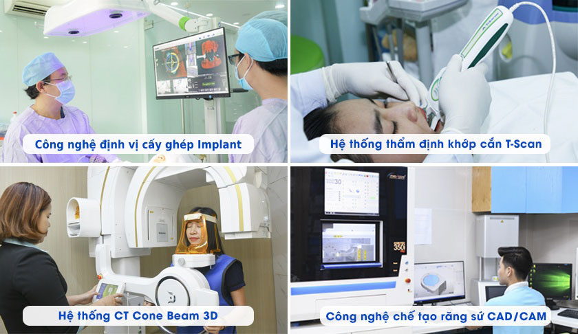 Kỹ thuật Implant All on 4