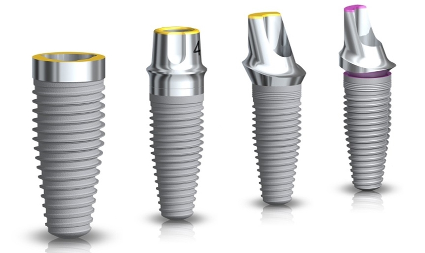 Kỹ thuật Implant All on 4