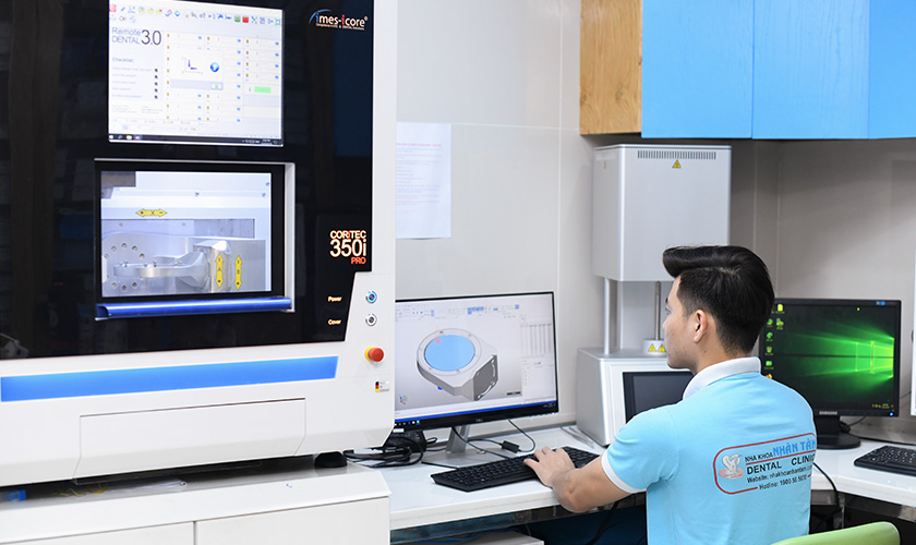 Kỹ thuật Implant All on 4