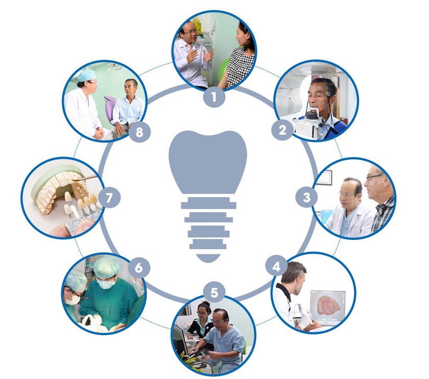 The dental implant process at Nhan Tam Dental