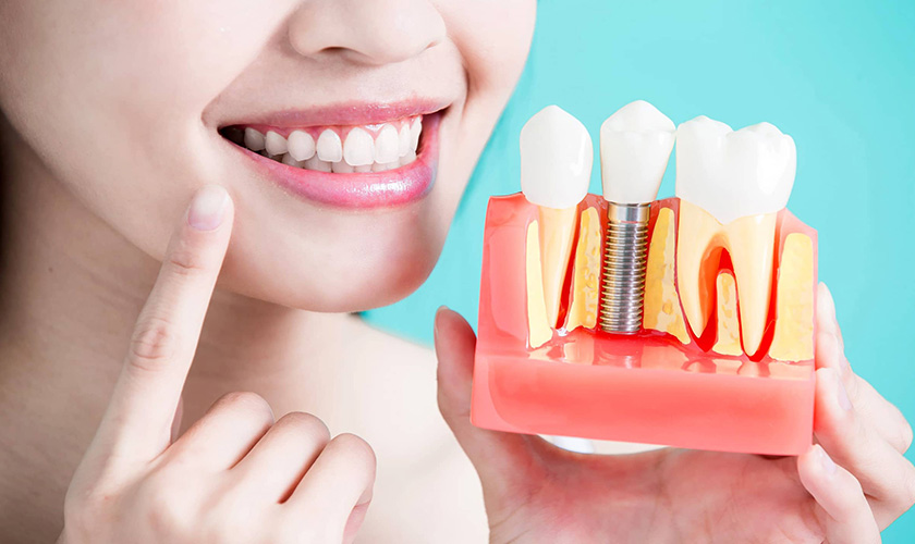 Implant restoration warranty terms