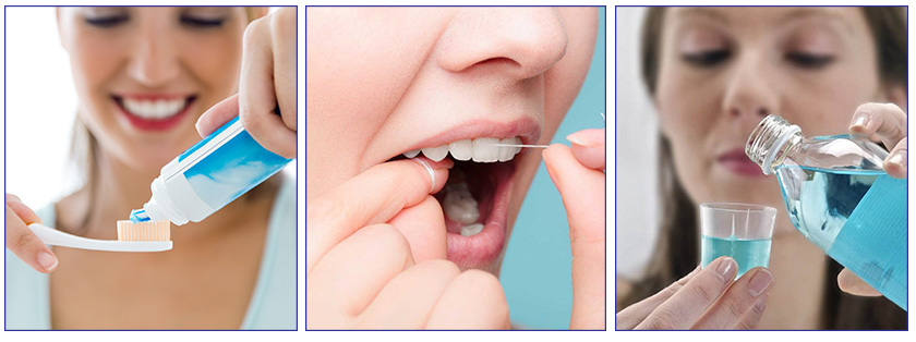 After implant placement, oral hygiene require special attention
