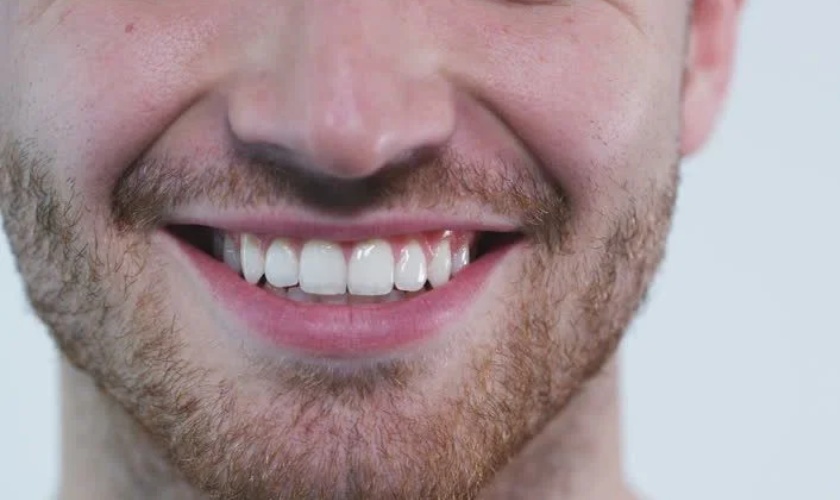 Hope you enjoy your new smile - Mr. Valentin!