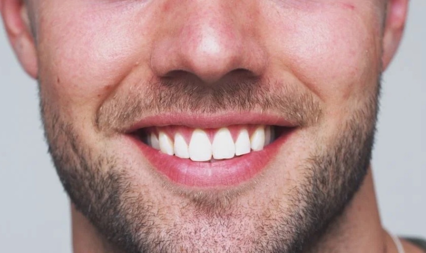 My new set of dentures as comfortable, look good!