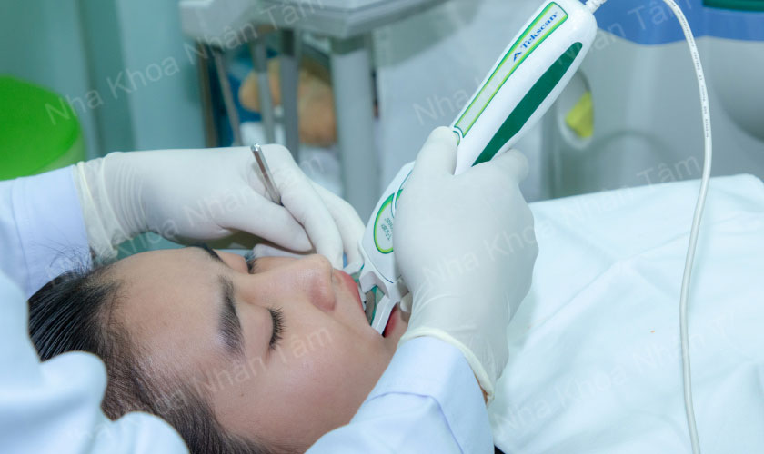 Hệ thống thẩm định – phân tích khớp cắn t-scan