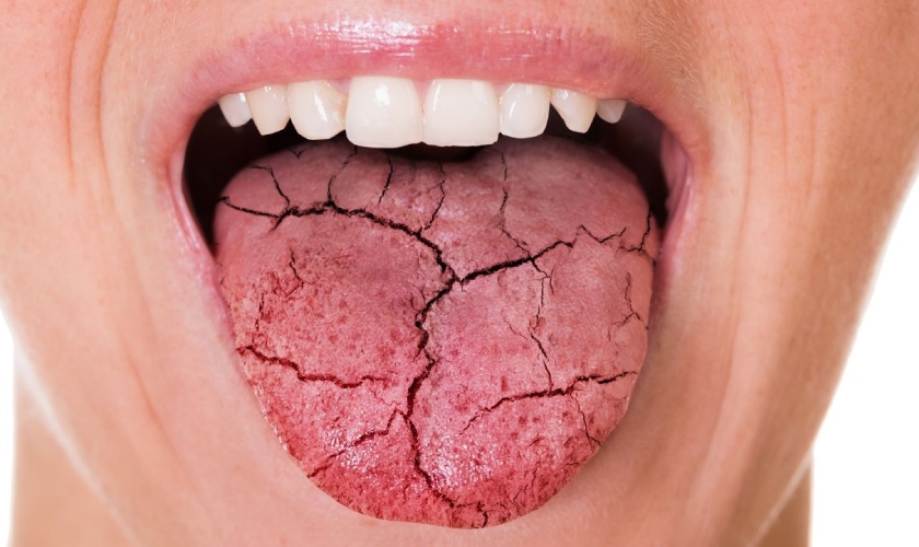 Reasons for bad breath