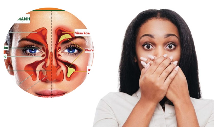Reasons for bad breath