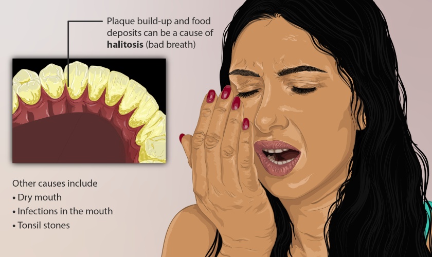 Bad breath can be caused by a number of diseases