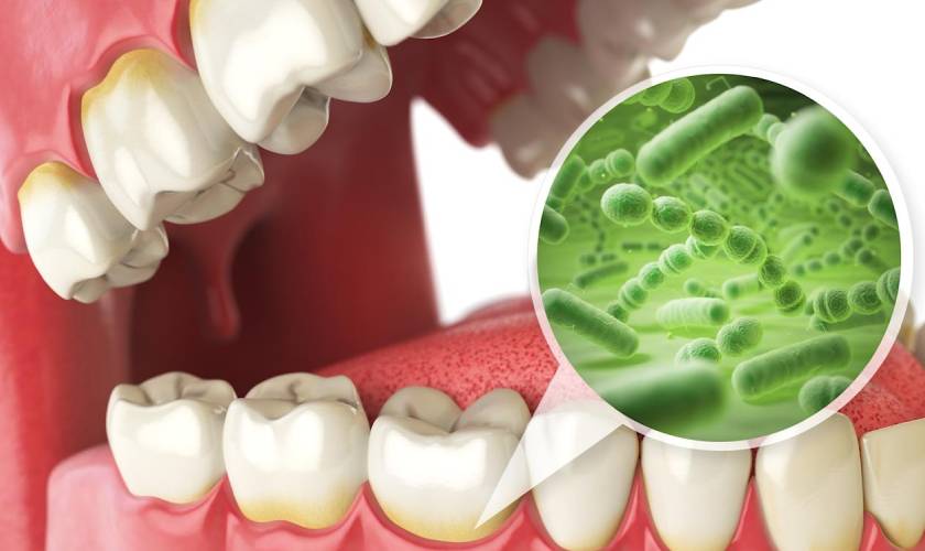 What Causes Bad Breath