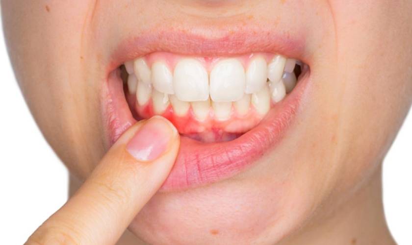 What Causes Bad Breath