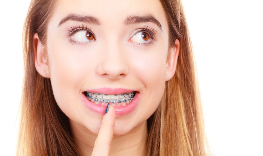 Not all cases wil require extractions