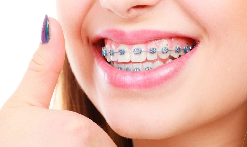 Orthodontics not only brings beautiful teeth, but also improves chewing and health