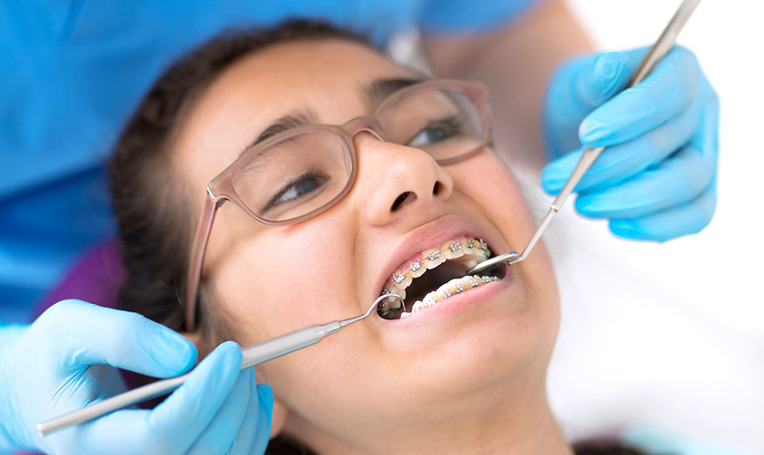 The average time for braces treatment takes about 18 - 30 months (1.5 - 2.5 years)