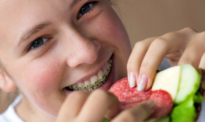 Pay attention to your diet when wearing braces