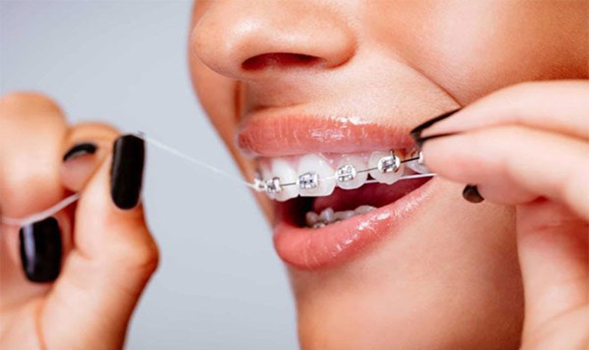 Floss at least once a day