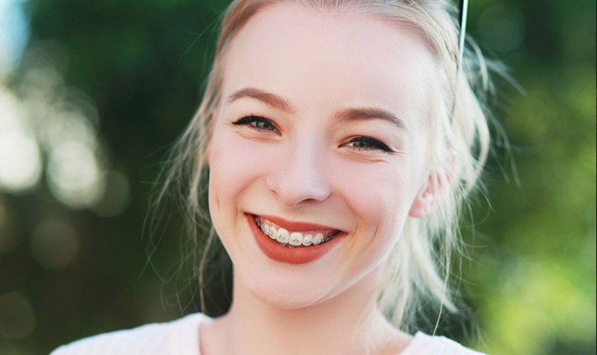 Braces help you have a confident smile, comfortable in eating as well as communication