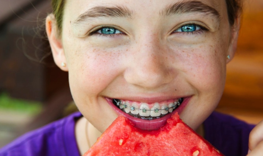 Things to know when braces